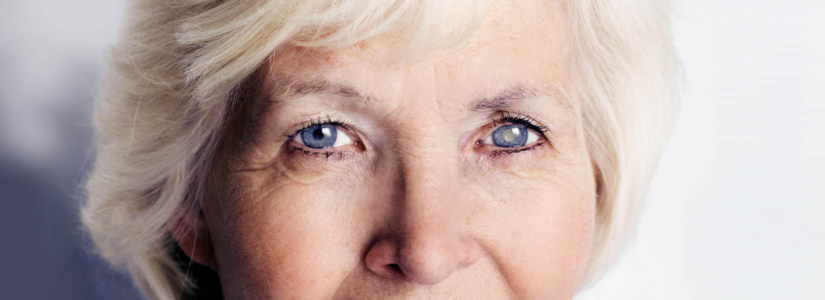 Cataract Surgery in Deerfield